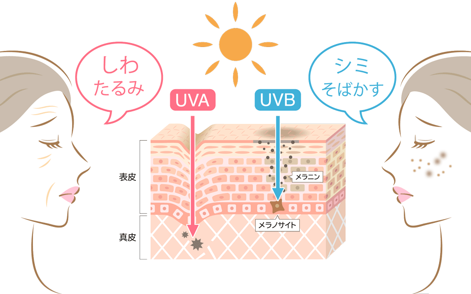 紫外線による肌ダメージ