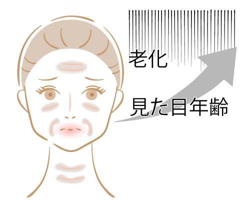 シワ・たるみを放置すると…