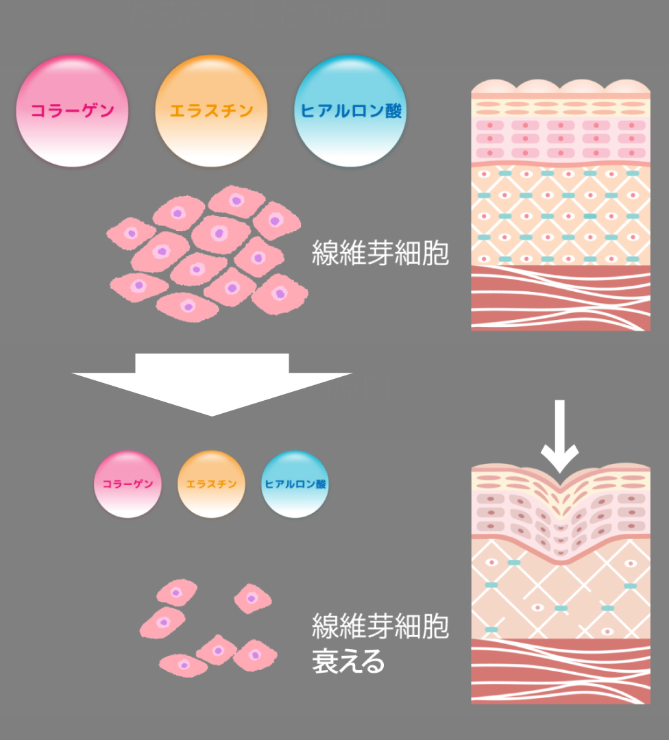 肌老化のメカニズム図