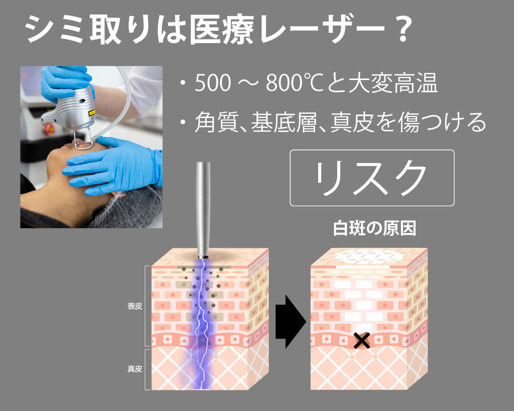 医療レーザー施術のリスク
