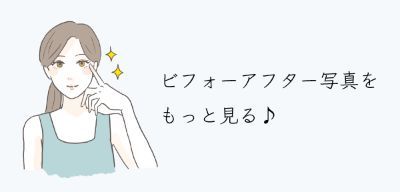 SAKURA施術のビフォーアフター