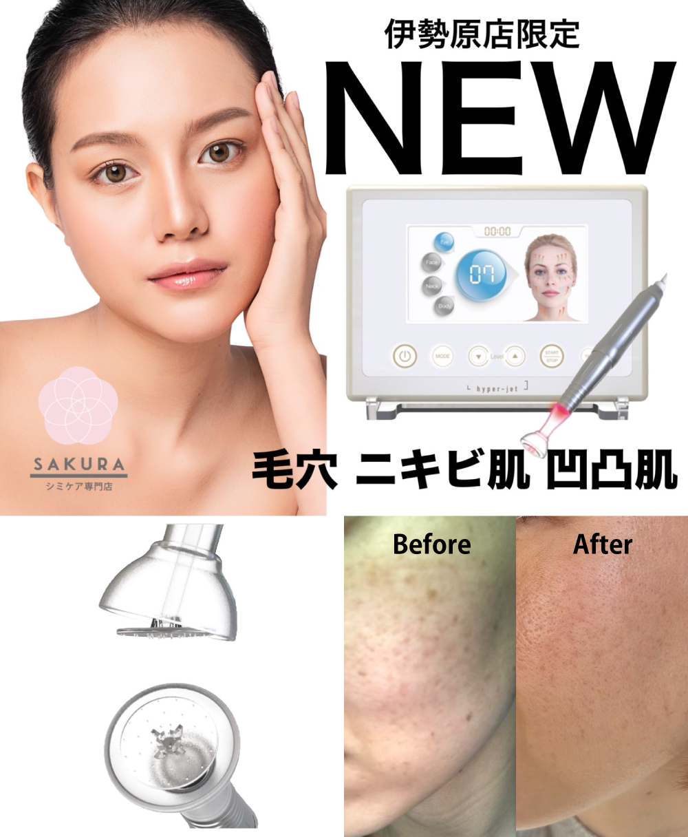 ハイパージェット(痛みのない美容版ダーマペン)